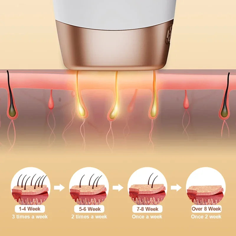 hair removal for women