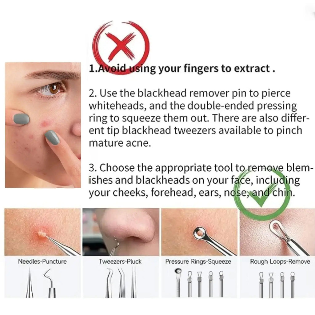 Professional blackhead remover