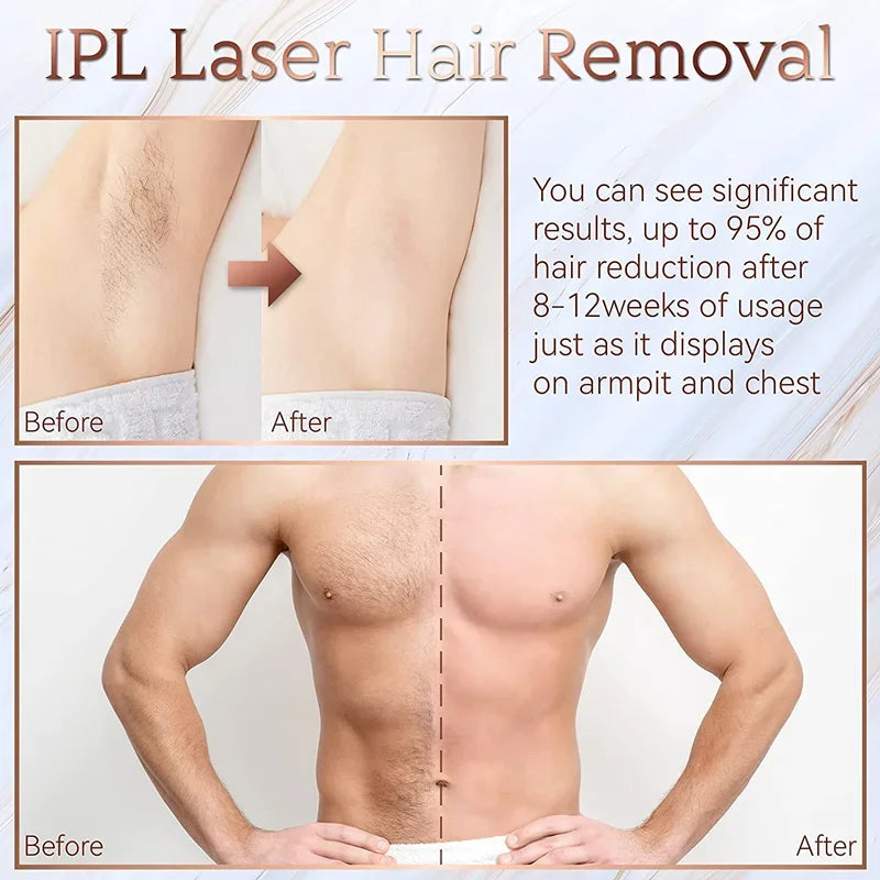 hair removal for women