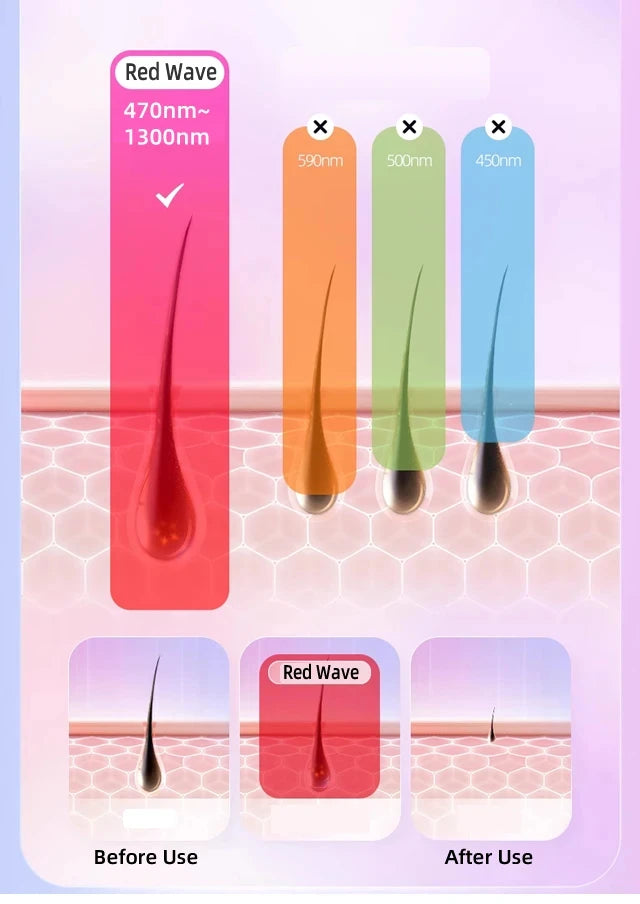 permanent hair reduction