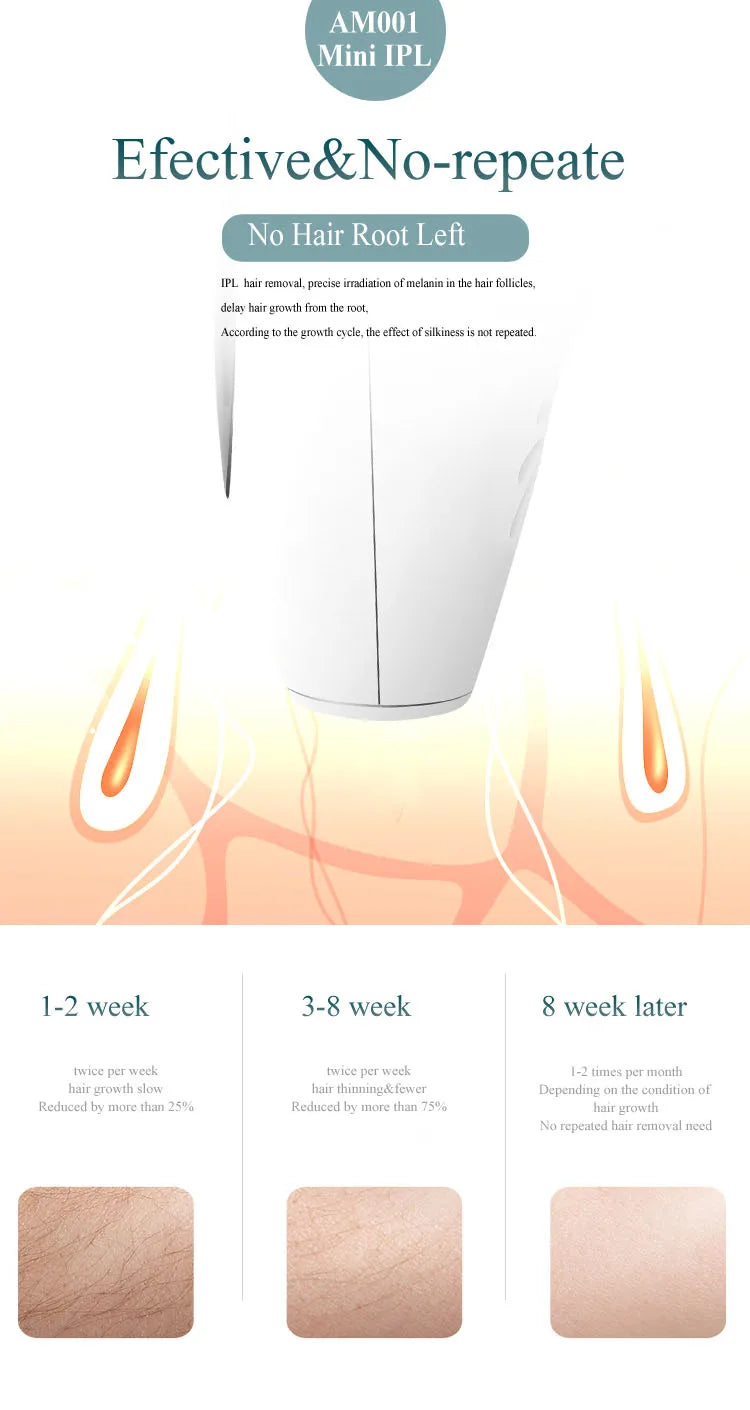 Skin rejuvenation IPL